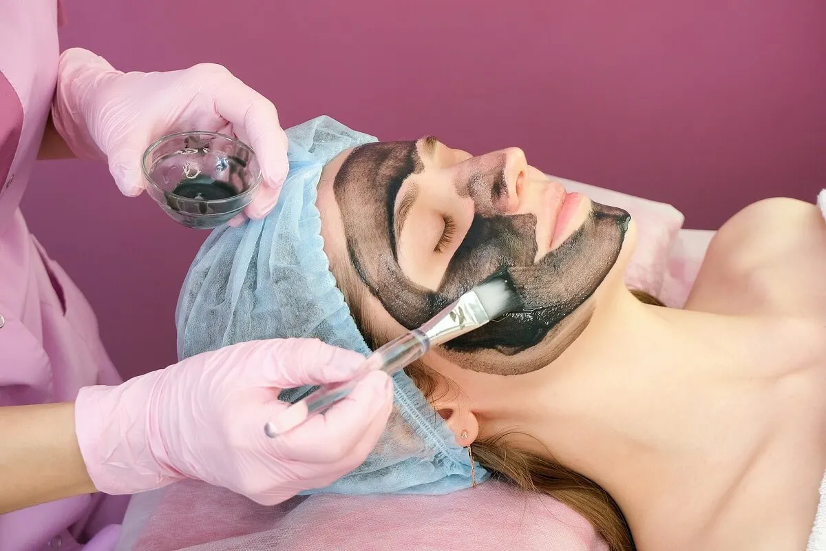¿Cómo se realiza la exfoliación láser con carbón activado?