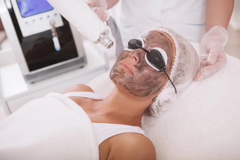Exfoliación láser con carbón activado: proceso y cuidados