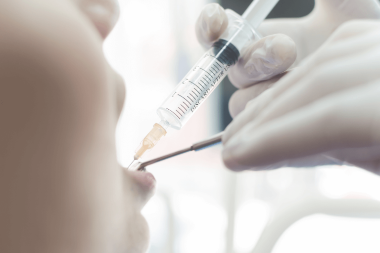 7 tipos de anestesia bucodental