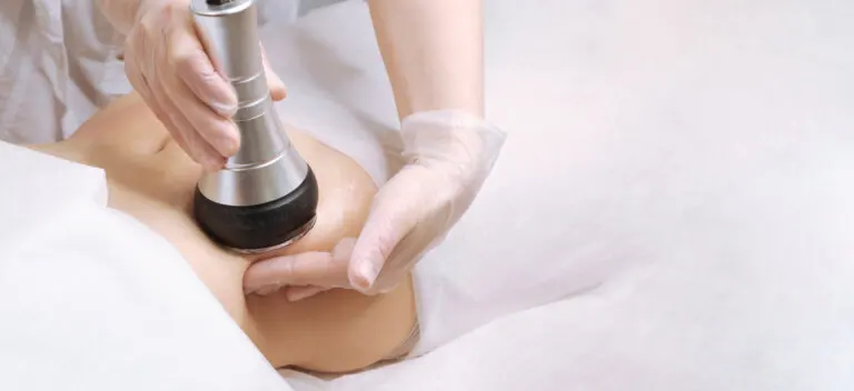 ¿Qué es el Coolsculpting ® y cómo funciona?