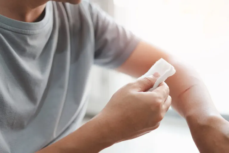 ¿Qué es el exudado de las heridas y por qué se produce?