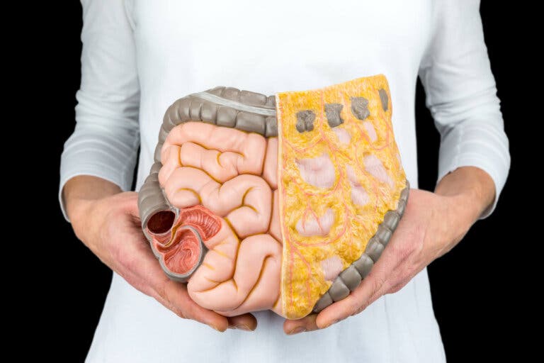 ¿Qué es el megacolon tóxico y por qué ocurre?