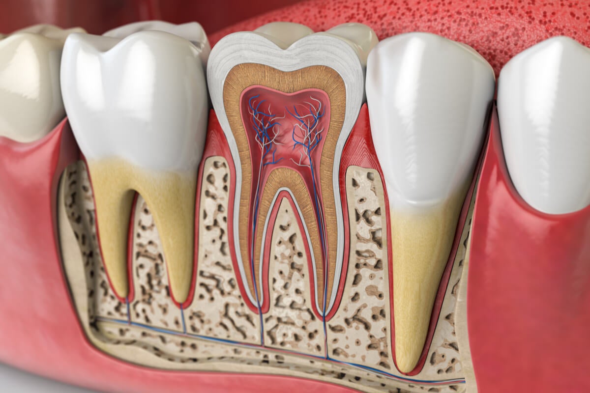 dentale Ankylose - Schaubild von Zähnen mit Wurzel