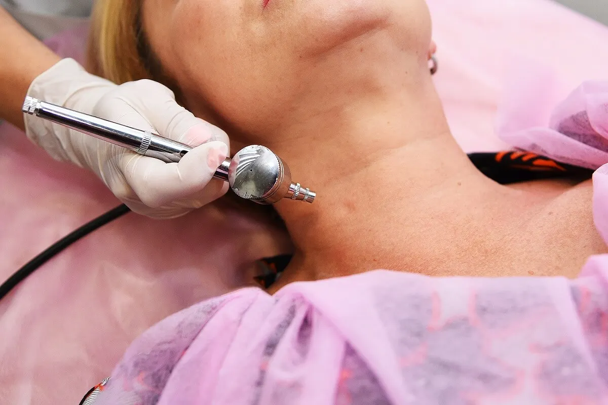 ¿Qué es el dermapen y cuáles son sus efectos en la piel?