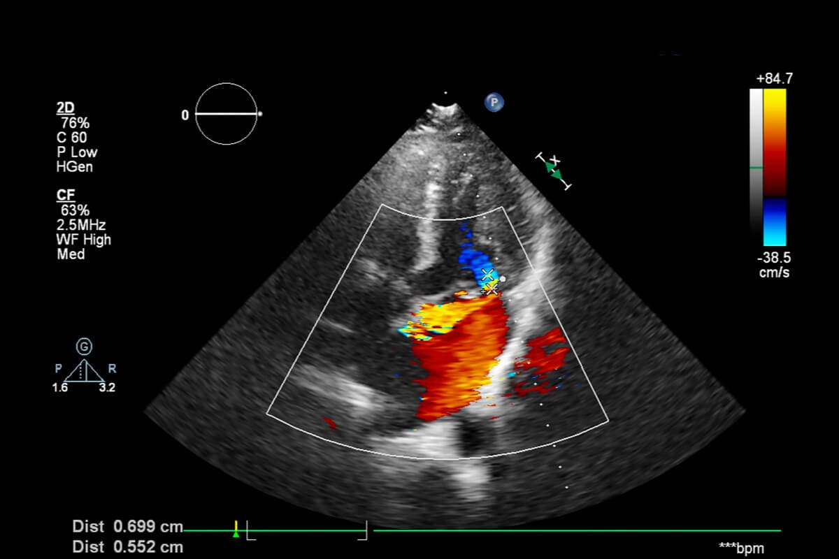 Een scan van een baby in de baarmoeder