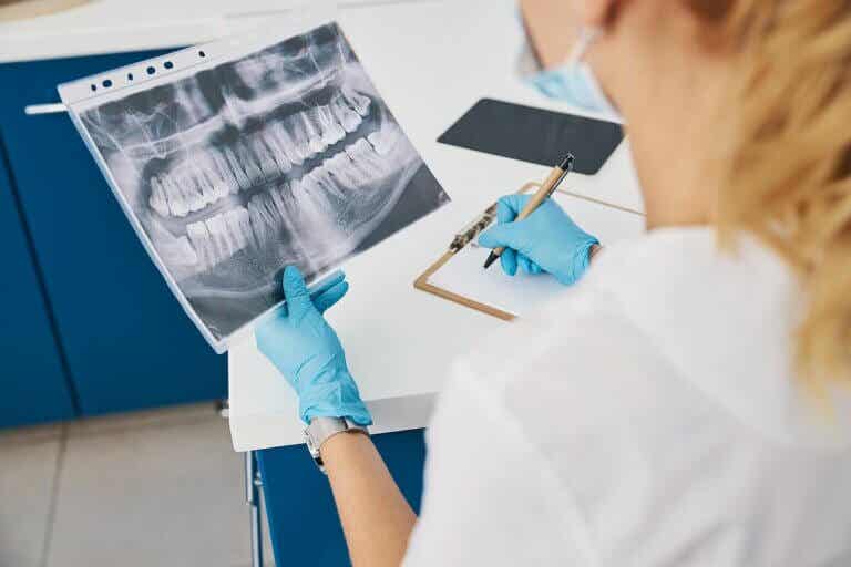 ¿Qué tipos de radiografías dentales existen?