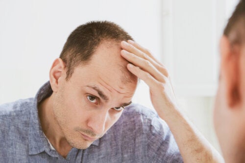 7 primeros signos de la alopecia: ¿cómo se puede actuar?