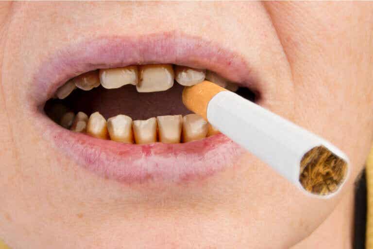 ¿Cómo afecta el tabaco la salud de los dientes?