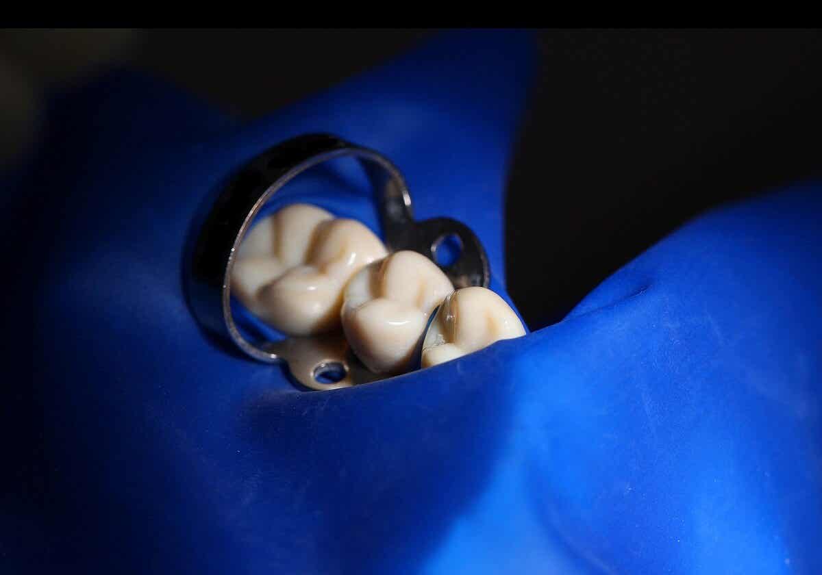 ¿Cómo se usan las grapas dentales?