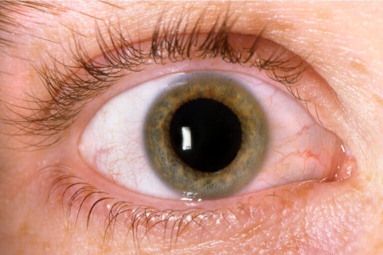 ¿Qué es la midriasis y por qué ocurre?