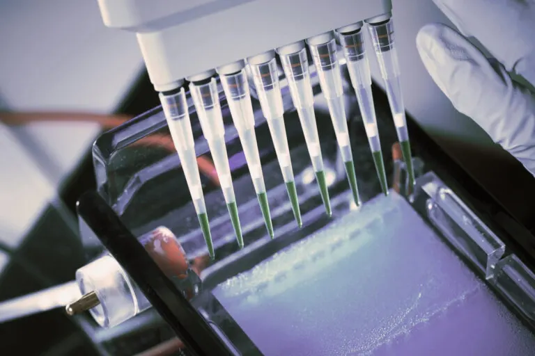 ¿Qué es una prueba de inmunofijación y para qué se utiliza?