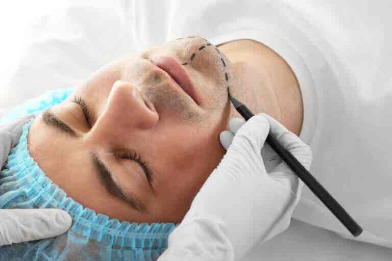 Cirugía de feminización facial: ¿qué es y cuáles son sus riesgos?