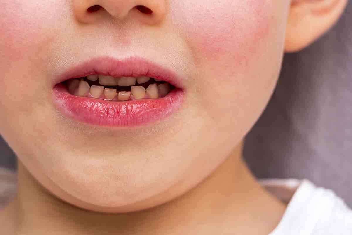Les dents des enfants sont plus blanches.