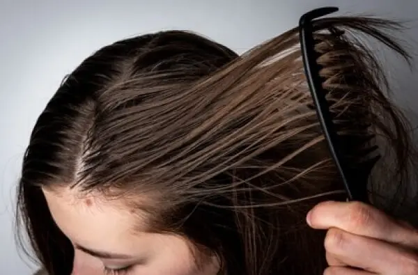 Cabello grasoso