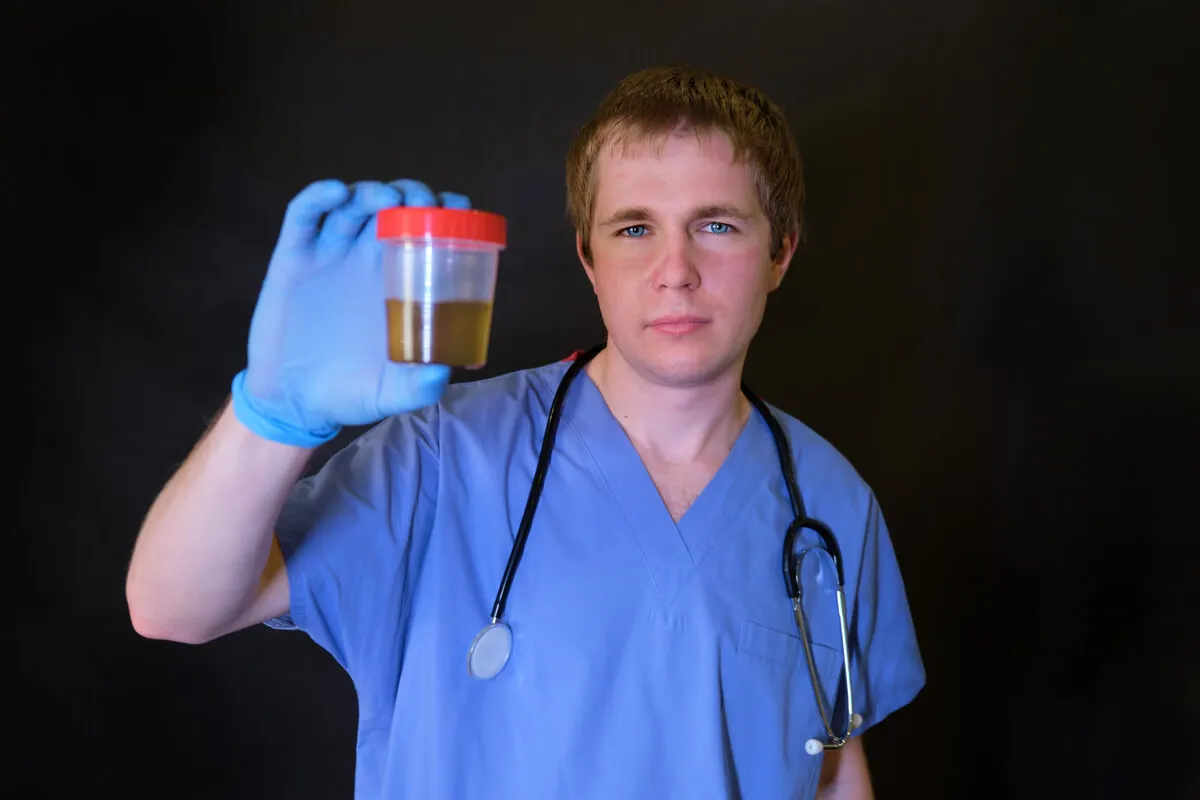 A urine sample.