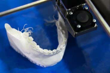 Impresión 3D en odontología: ¿en qué consiste?