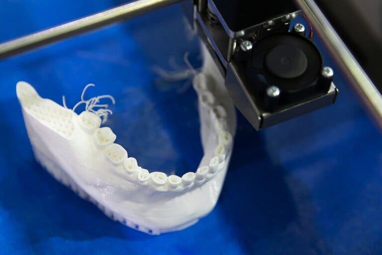 Impresión 3D en odontología: ¿en qué consiste?