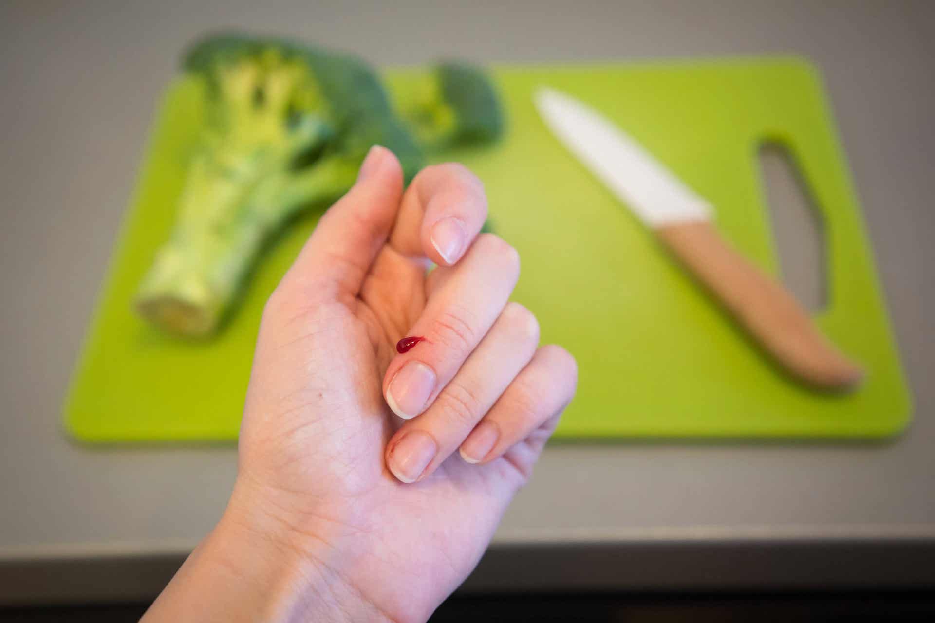 Cooking Injury 7 risques dans une cuisine et conseils de sécurité