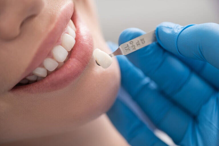 Fundas de dientes: ¿cuándo debería utilizarlas?