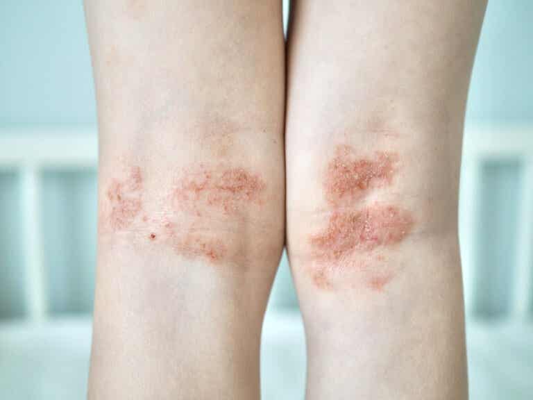 Red spots on the skin: causes and how to eliminate them