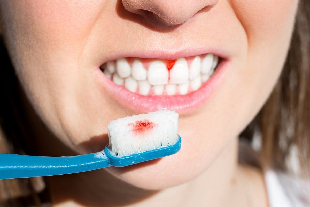 7 consejos para prevenir la periodontitis
