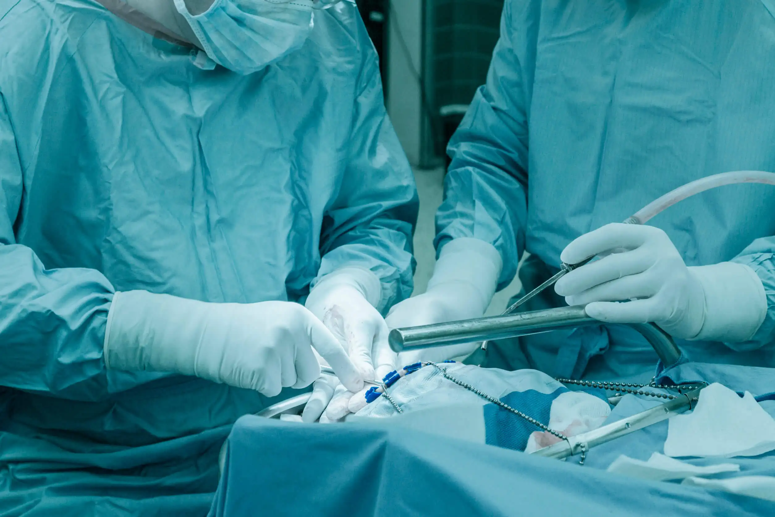 Chirurgie de l'anévrisme cérébral.