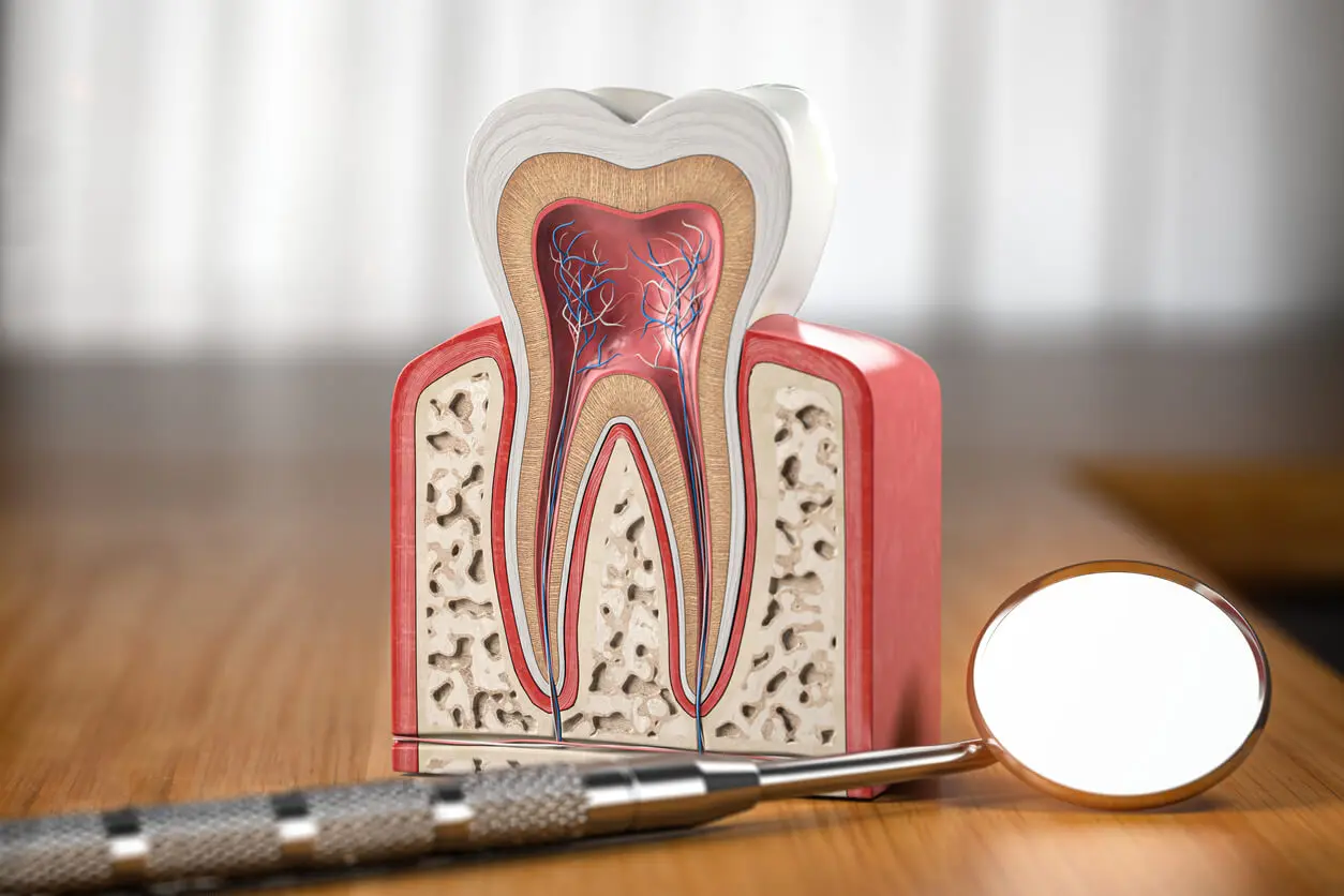 Estrutura de um dente com sensibilidade.