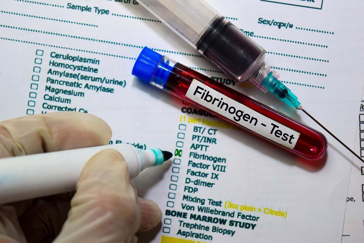Prueba de fibrinógeno en sangre: funciones y resultados