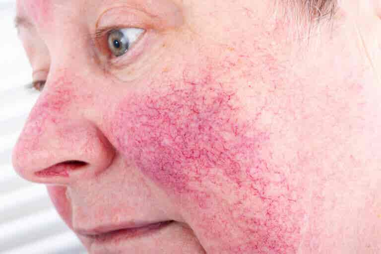 15 enfermedades comunes en la piel y cómo tratarlas