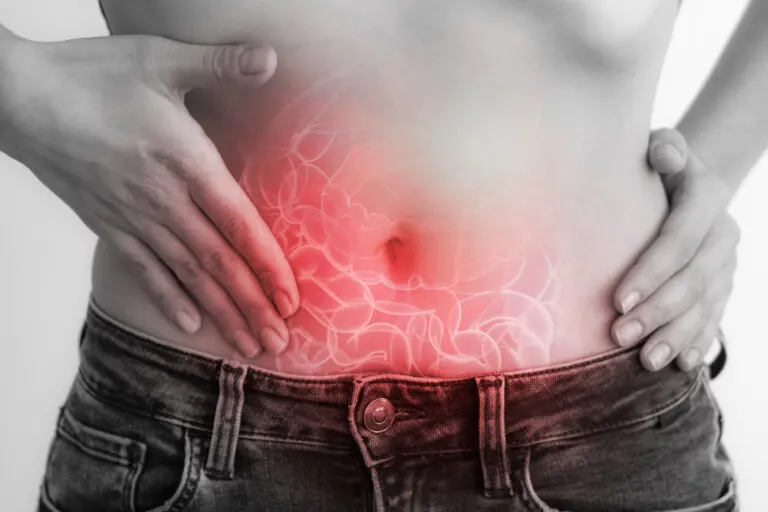 Apendicitis o gases: ¿cómo diferenciar el dolor?