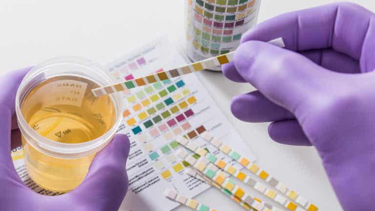 Grasa en la orina: posibles causas y qué hacer - Mejor con Salud