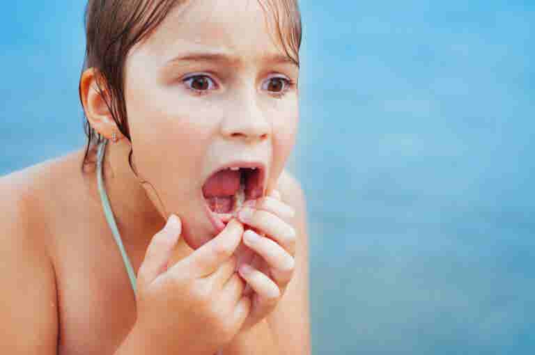 ¿Qué hacer si mi hijo se golpea en los dientes de leche?