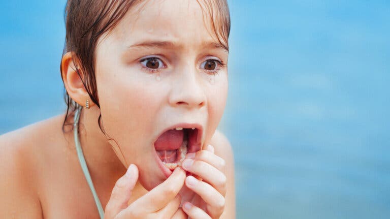 ¿Qué hacer si mi hijo se golpea en los dientes de leche?
