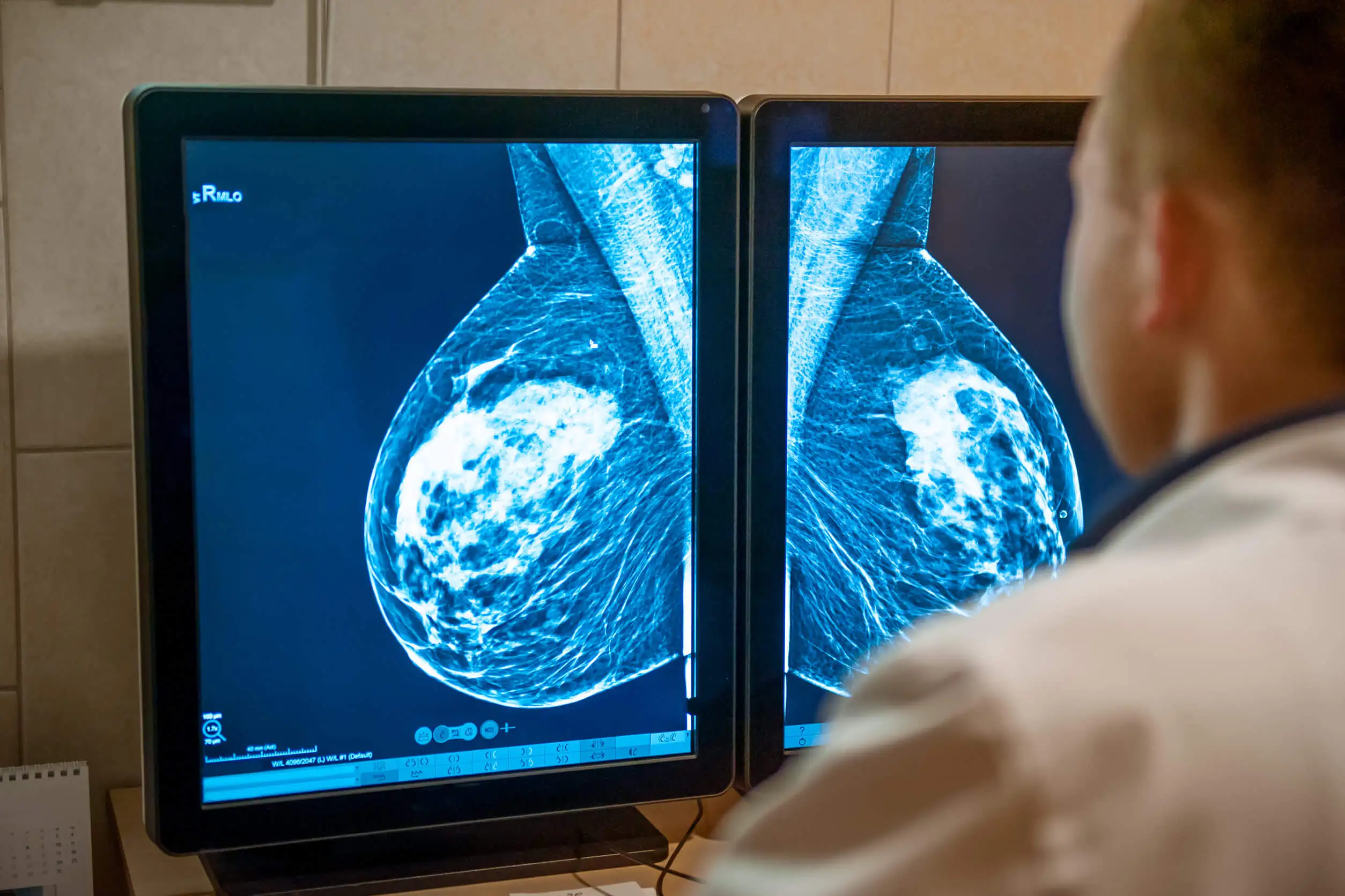Dokter bekijkt een scan