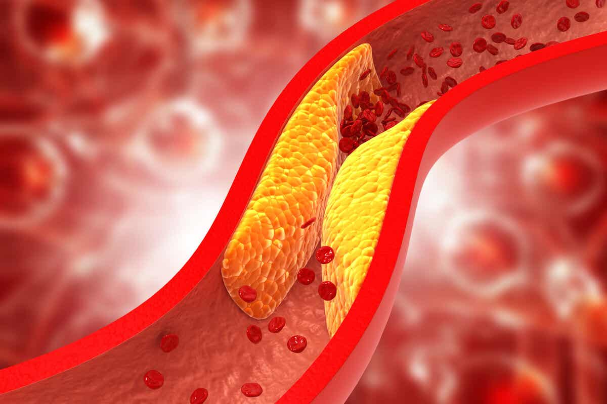 Wachteleier - Cholesterin in den Blutgefäßen