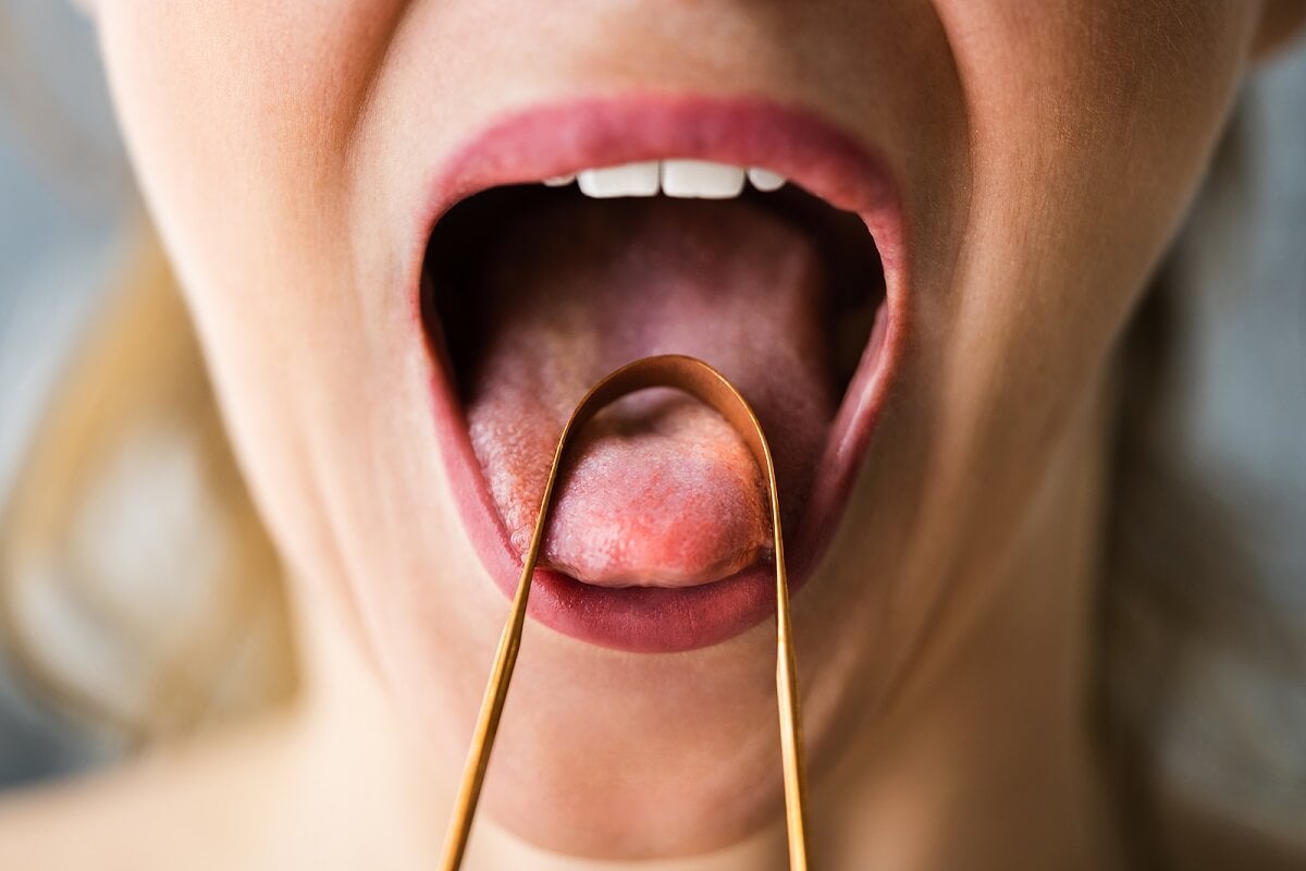 ¿En qué consiste el raspado de la lengua?