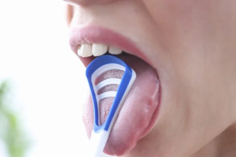 ¿El raspado de lengua tiene beneficios para la salud?