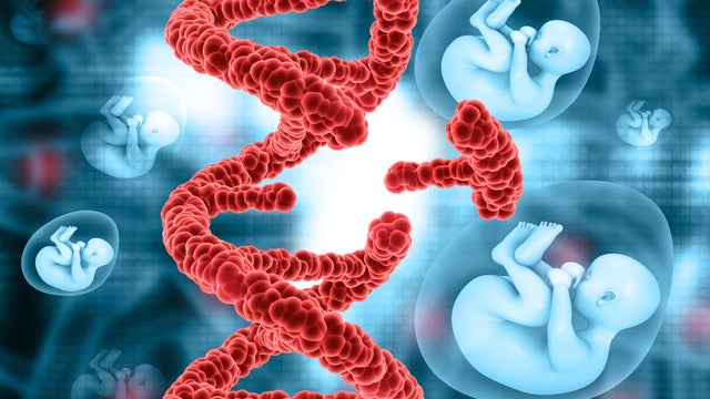 Long-QT-Syndrom (LQTS): Was ist das? - Besser Gesund Leben