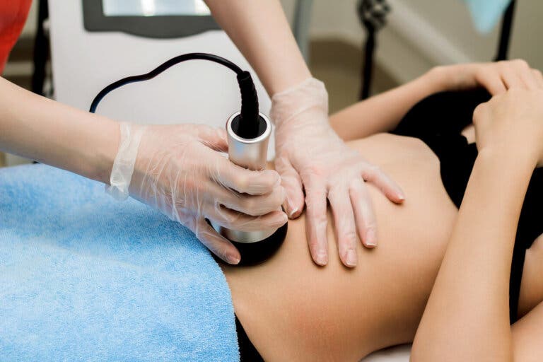 Tratamiento Cyclone contra la celulitis: en qué consiste