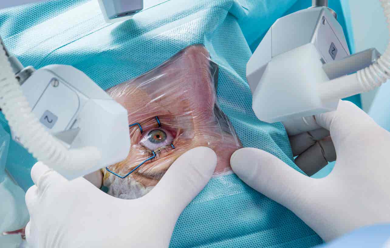 Chirurgie des yeux avec aniridie.