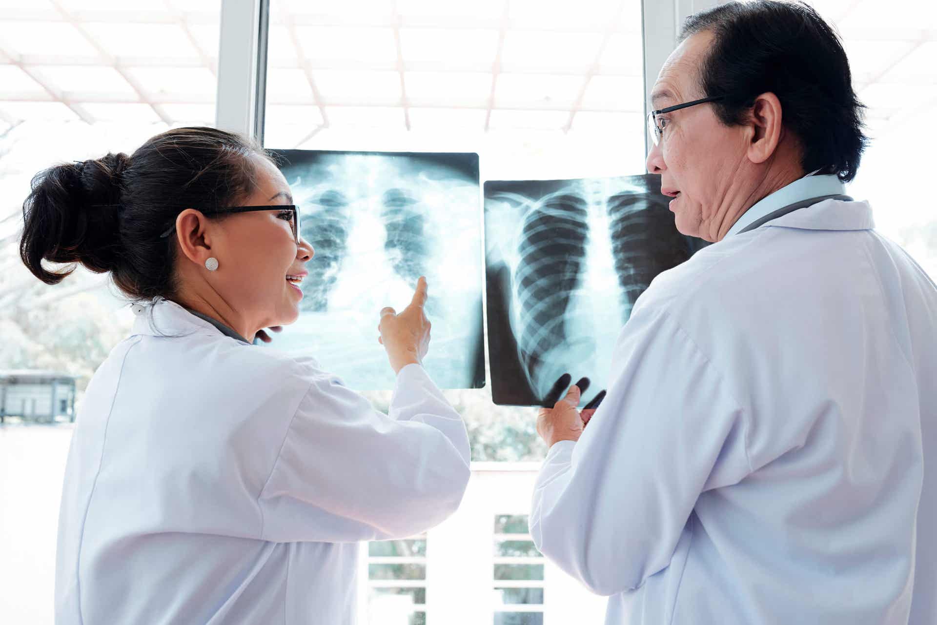 Lekarze patrzący na zdjęcia rentgenowskie