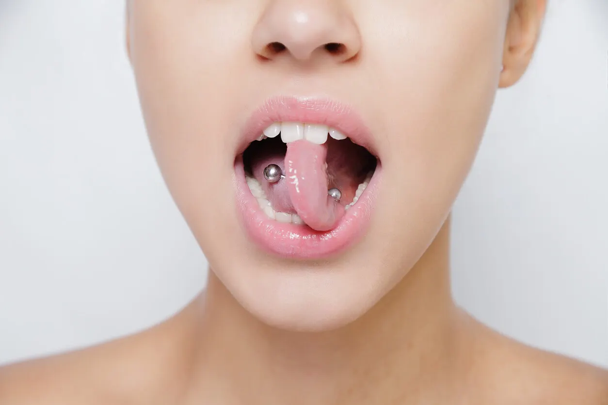 Beule um ein Piercing - Zungenpiercing