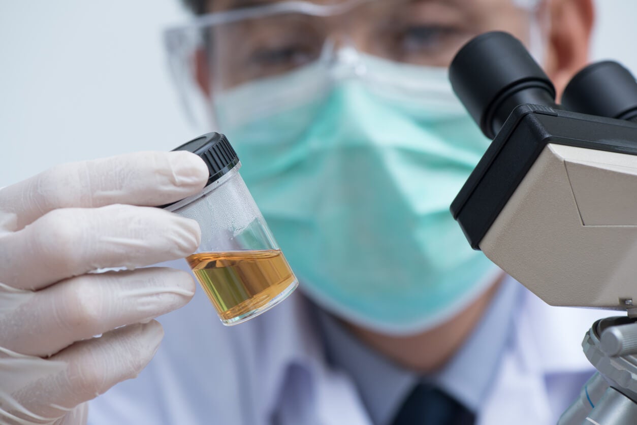 a urine analysis for scrotal masses 