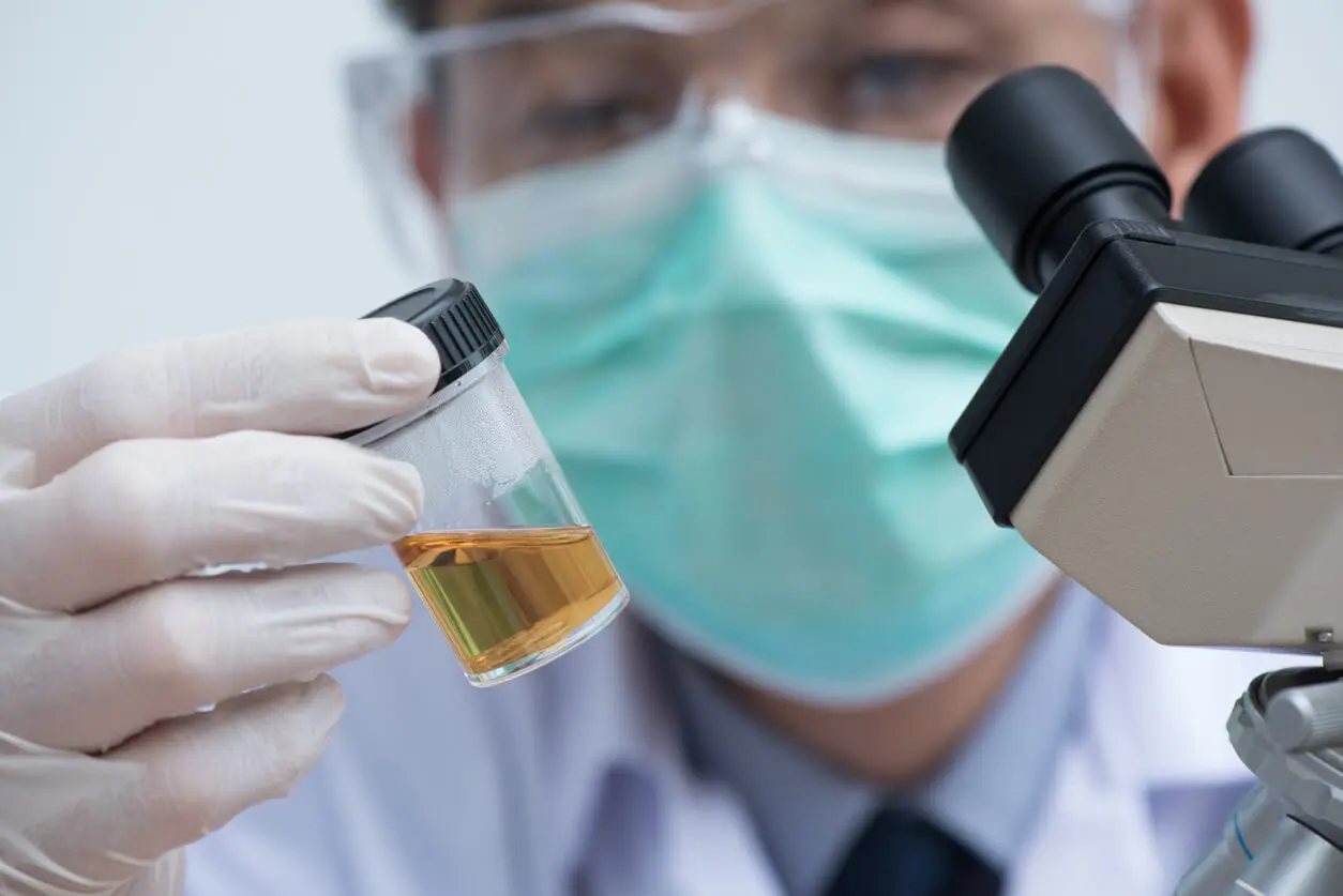 a urine analysis for scrotal masses