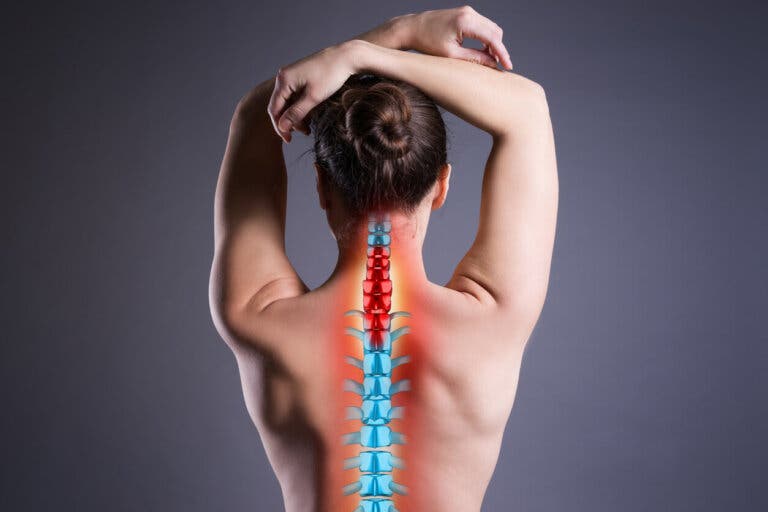 Osteofitos: qué son, síntomas y tratamientos