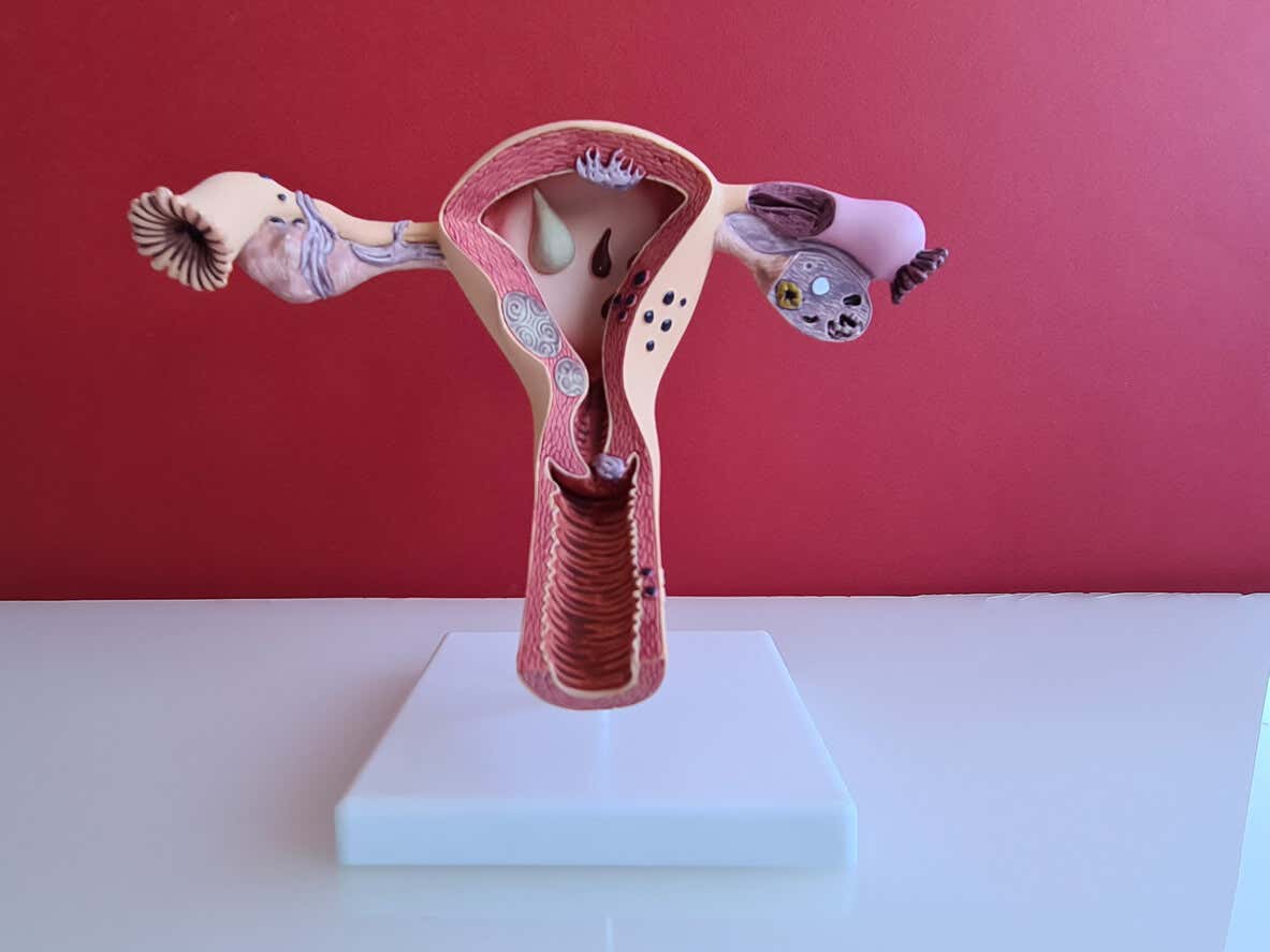 Anatomia do útero.