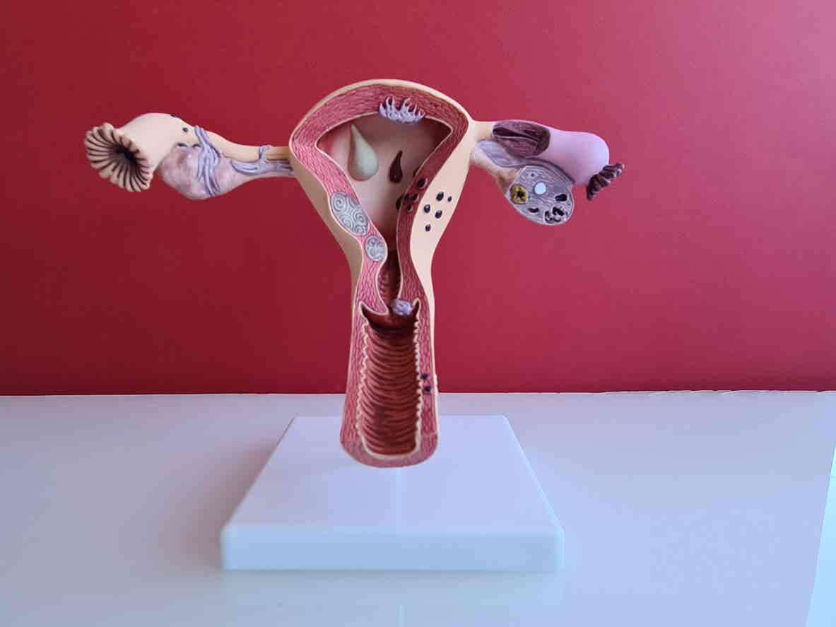 Anatomía del útero.