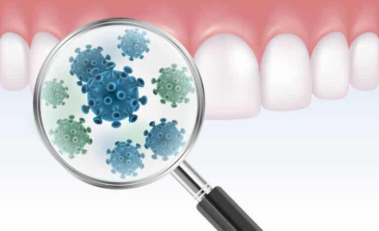 Todo lo que debes saber sobre la placa bacteriana dental