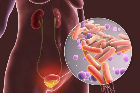 Bacterias En La Orina: 4 Causas Y Tratamientos - Mejor Con Salud