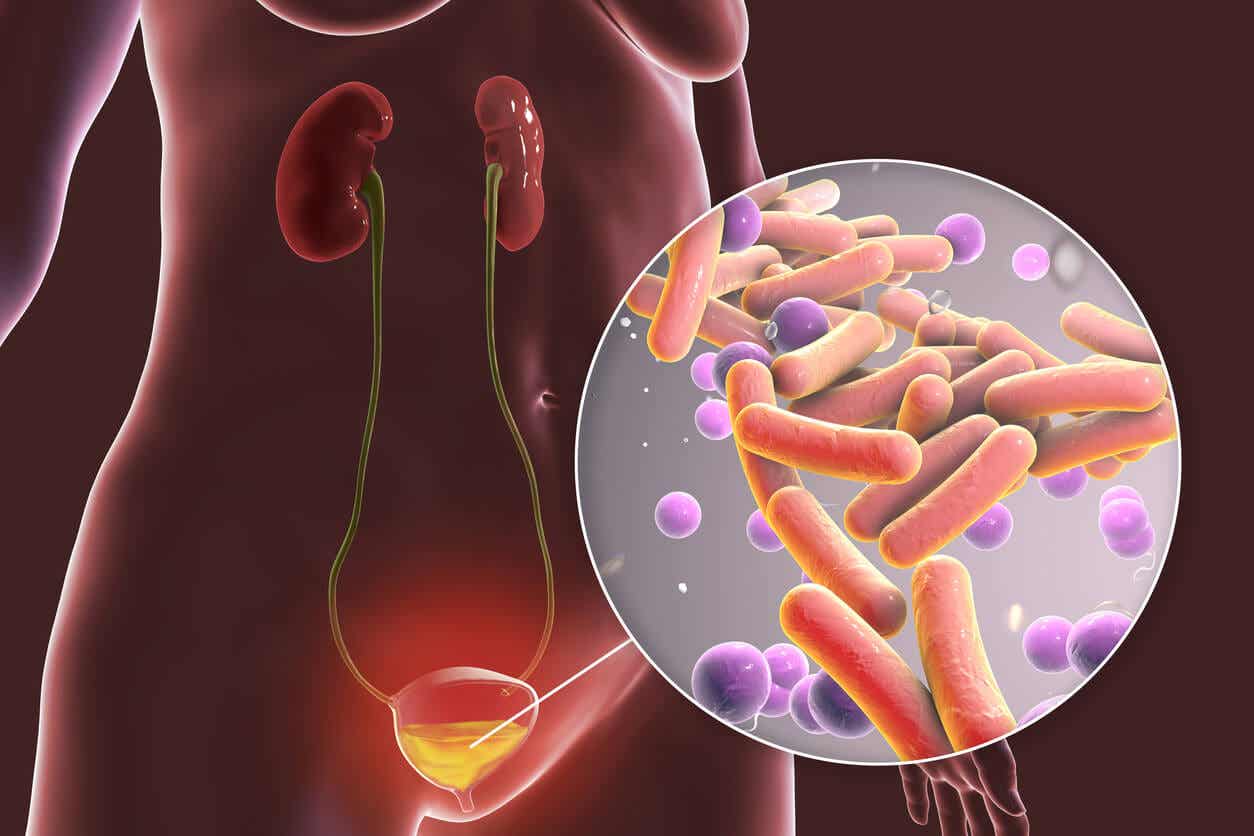 Bacterias en la orina: 4 causas y tratamientos